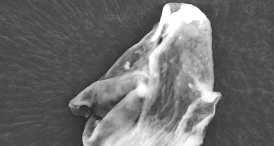 英謝菲爾德大學(xué)的研究人員在探空氣球中采集樣本中發(fā)現(xiàn)了硅藻屬植物